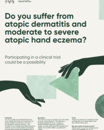 Atopic Dermatitis | Chronic Hand Eczema Clinical Trial Flyer